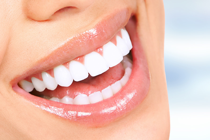 Ceramic Restorations in 