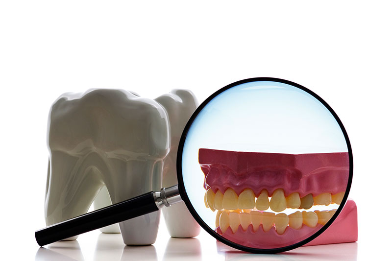 Root Canal Treatment in Littleton