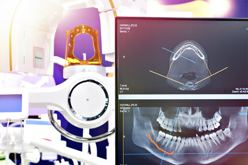Digital X-rays in Littleton