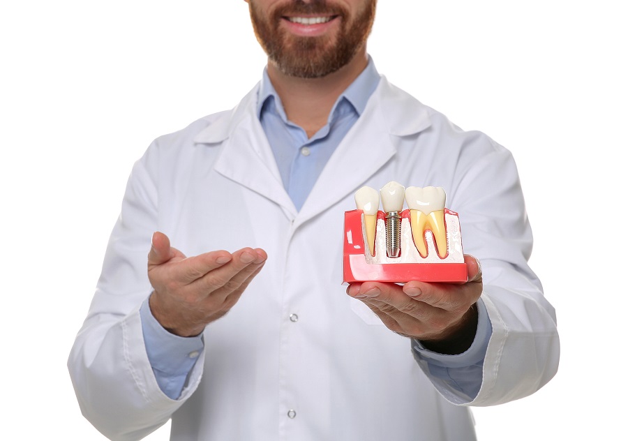 Why Consider Dental Implants for Missing Teeth