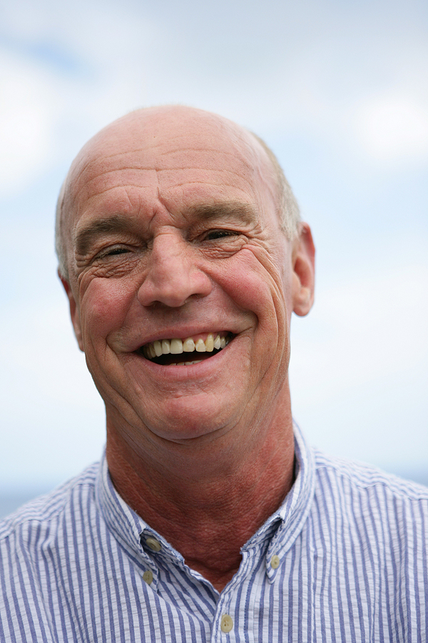 Maximizing Dental Implant Lifespan: The Essential Role of Osseointegration